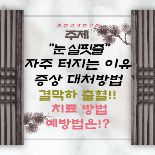눈 실핏줄 터지는 이유 원인 결막하 출혈 자주 터지는 이유 치료방법