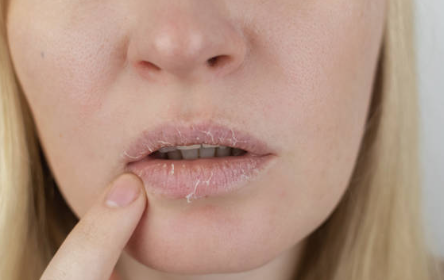 입냄새 원인 구강 건조증