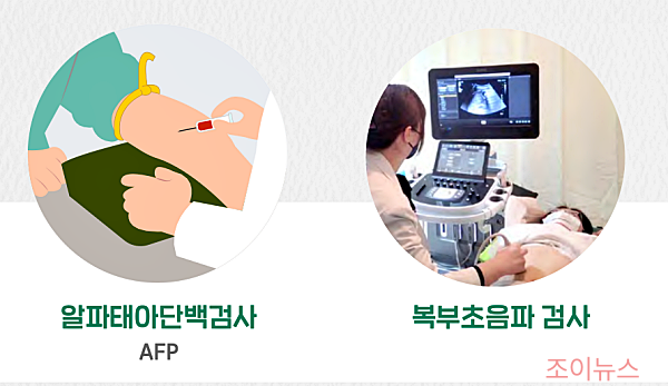 국가건강검진 간암검사 AFP, 초음파_국립암센터