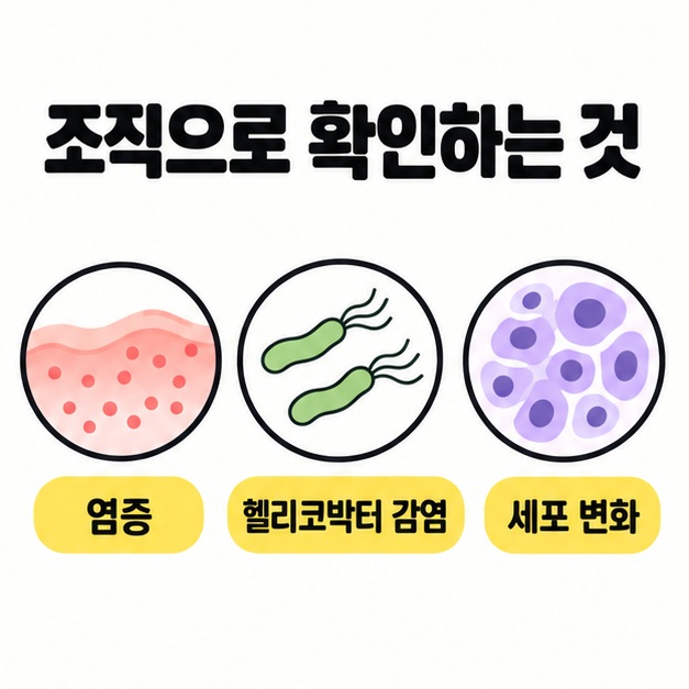 조직을 통해 염증, 헬리코박터 감염, 세포 변화를 확인하는 세 가지 검사 목적의 분류 도식