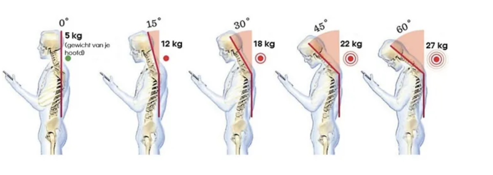 머리꺽이는 정도에 따른 척추가 느끼는 무게 추이 이미지