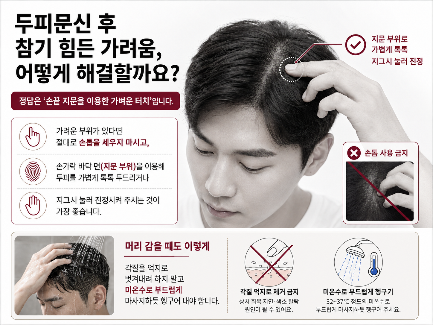 두피문신 후 가려울때, 두피문신 전후 관리