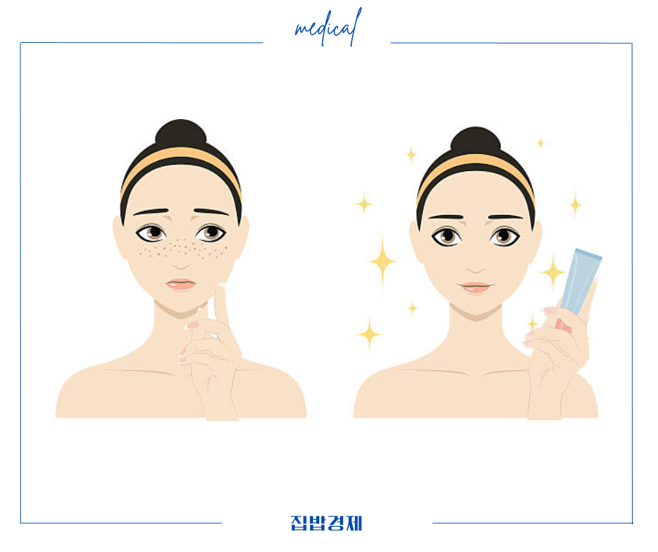 멜라토닝 크림 효과