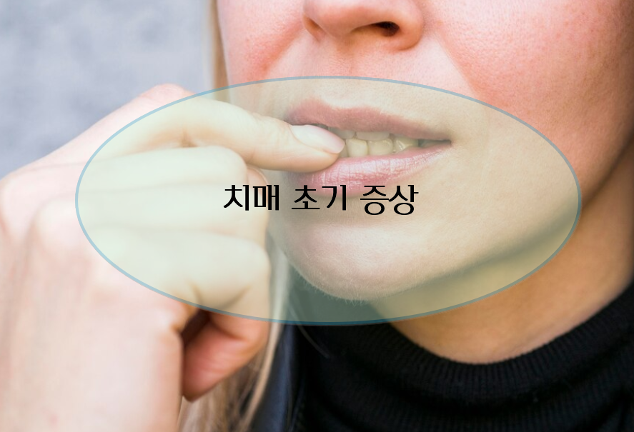 치매 초기 전조증상 8가지