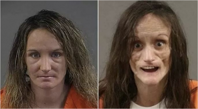 마약을 복용하면 식욕이 없어지고 온 몸이 깡마르게 된다