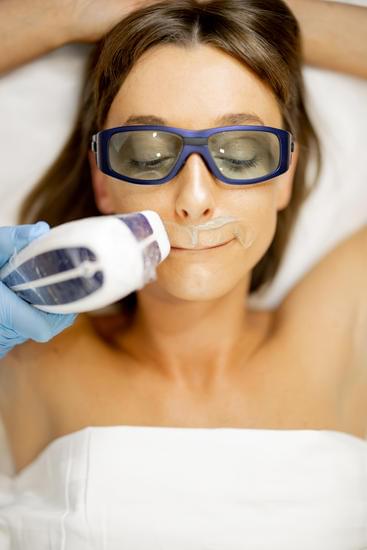 인중 제모 방법 및 장단점