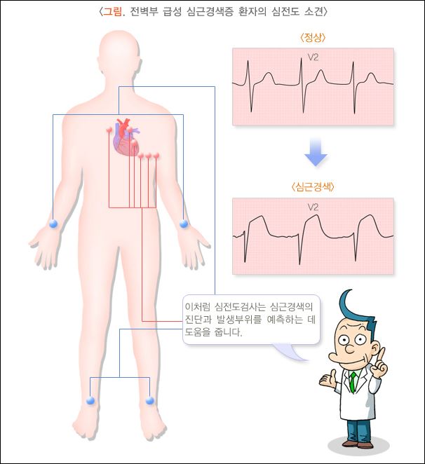 심근경색증 심전도검사 바로가기(사진출처-질병관리청)