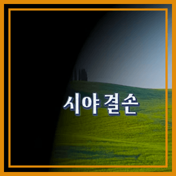 눈 검은것이떠다니는것