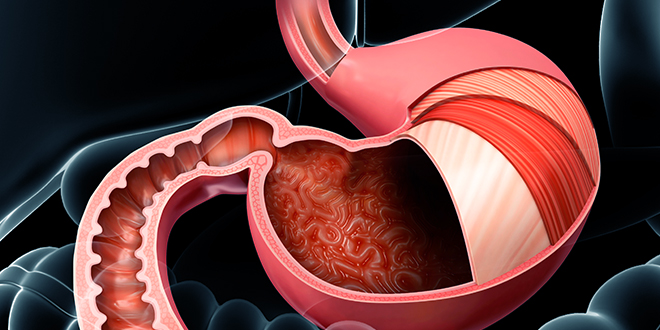 대장내시경 전 음식주의사항 전날 음식 대장내시경 약 복용법