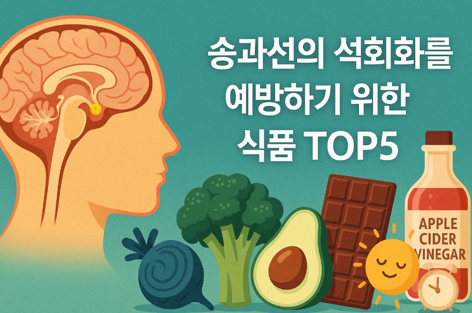 디지털 일러스트 배경에 뇌의 중심부에 위치한 송과선이 강조되어 있으며, 주변에는 브로콜리, 강황, 해조류, 카카오, 사과식초와 같은 송과선 건강에 좋은 식품 이미지가 배치되어 있다. 전체적으로 자연스러운 녹색과 황금빛 색조가 조화를 이루며, 중앙에는 "송과선의 석회화를 예방하기 위한 식품 Top5"라는 문구가 선명하고 크게 삽입되어 있다. 이 이미지는 송과선 건강과 관련된 식습관의 중요성을 직관적으로 표현하고 있다.