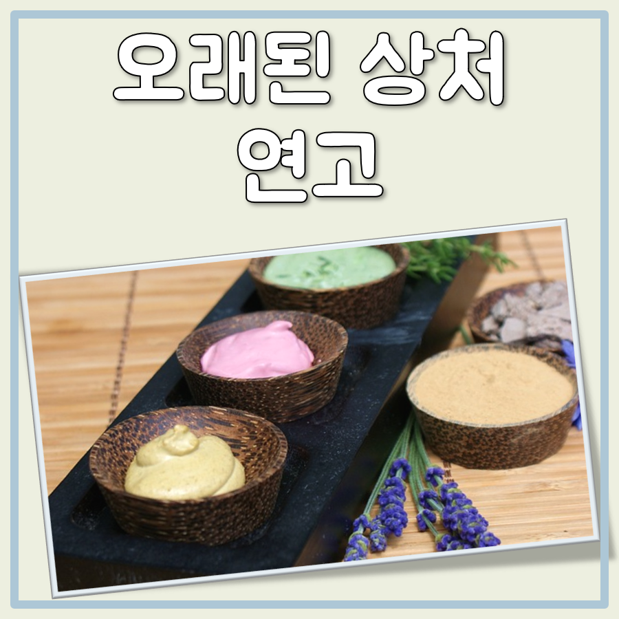 오래된 상처 연고 대표 이미지