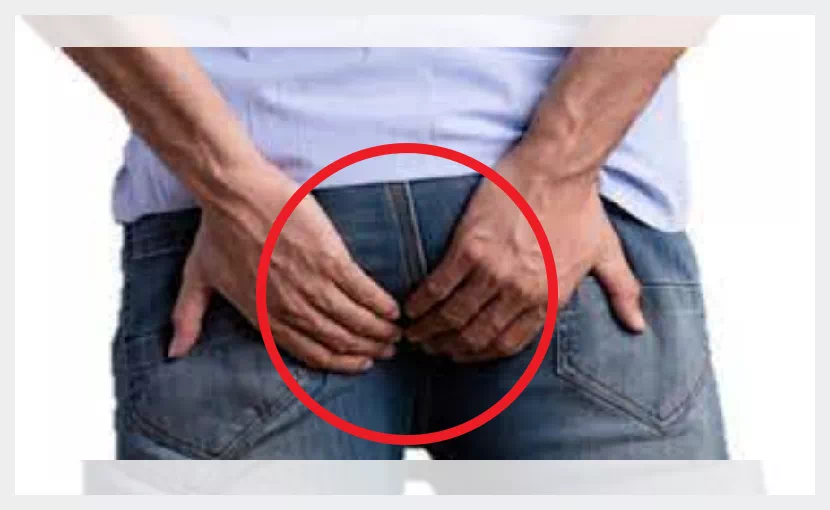 항문거근증