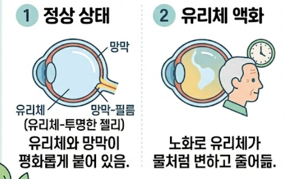 광시증 증상