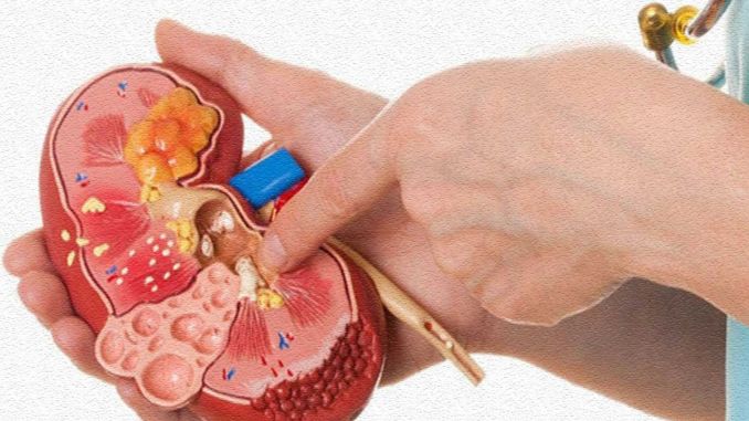 신장에 좋은 음식 15가지