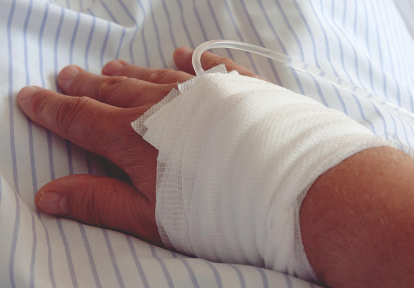 슬와동맥 포착증후군, 괴사까지 초래하는 혈류 장애가 발생하는 희귀 질환