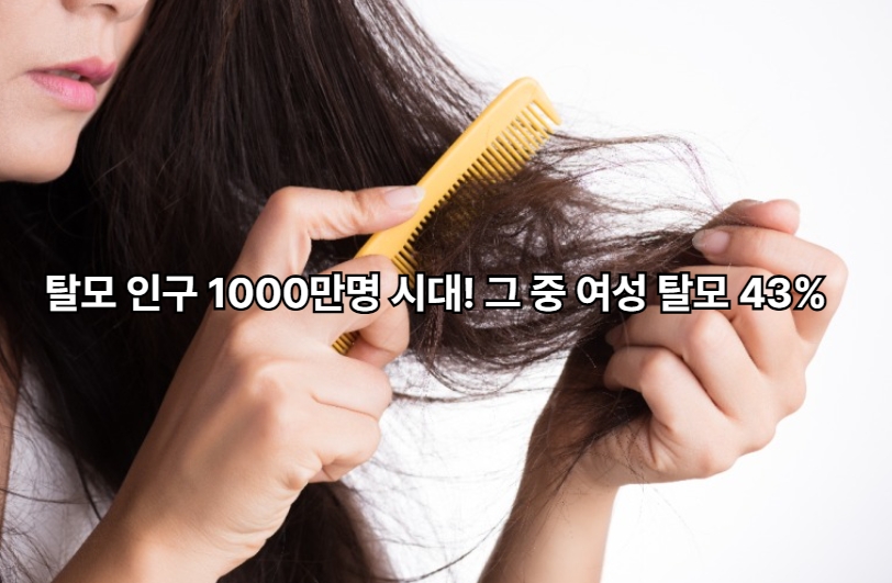 탈모 인구 1000만명 시대! 그 중 여성 탈모 43%