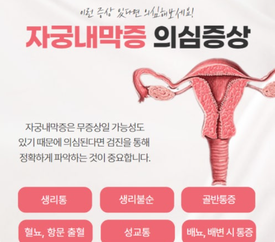 자궁내막증 관련 이미지