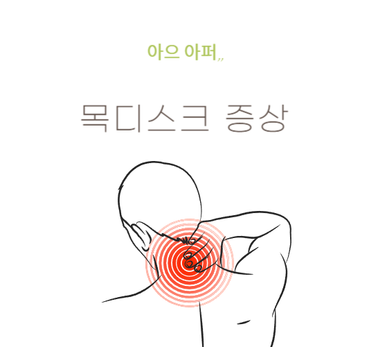 목디스크-증상,원인,예방법