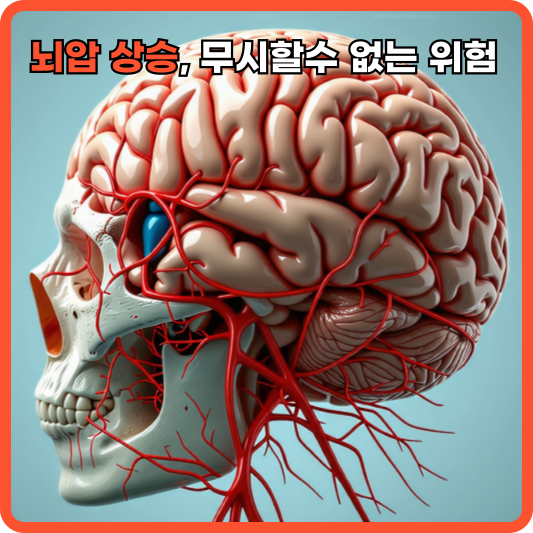 뇌압 상승