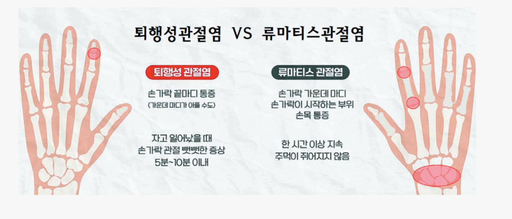 통증 완화를 위한 치료법