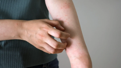 팔을 긁는 남성