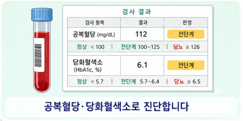 진단 방법과 혈당 수치 기준