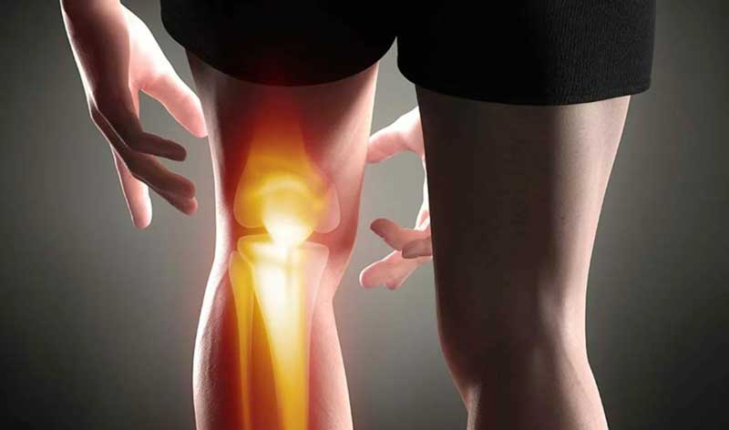 무릎통증 관련 이미지