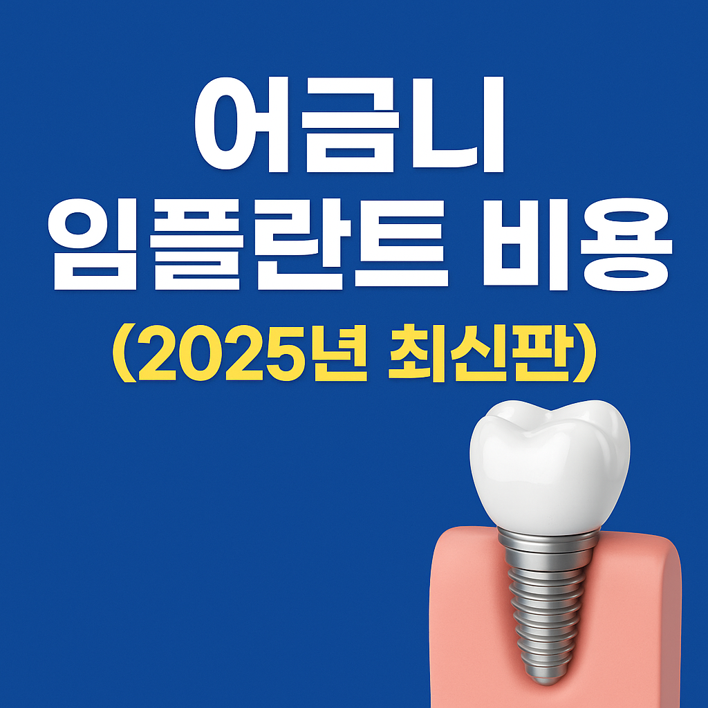 어금니 임플란트 비용 총정리