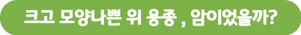 위 용종 제거 후 식사 주의사항