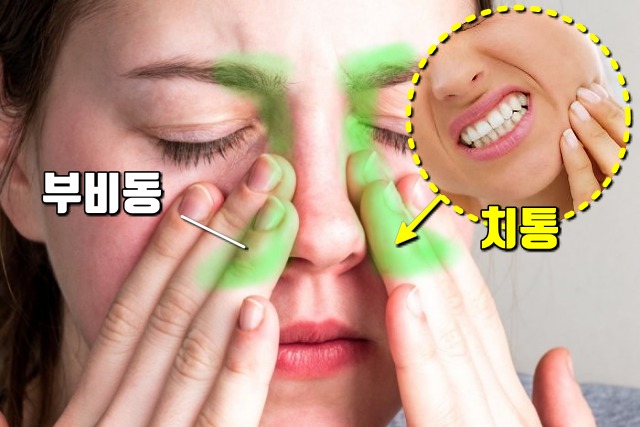 치통 심할때,갑자기 이가 아파요,부비동염 축농증