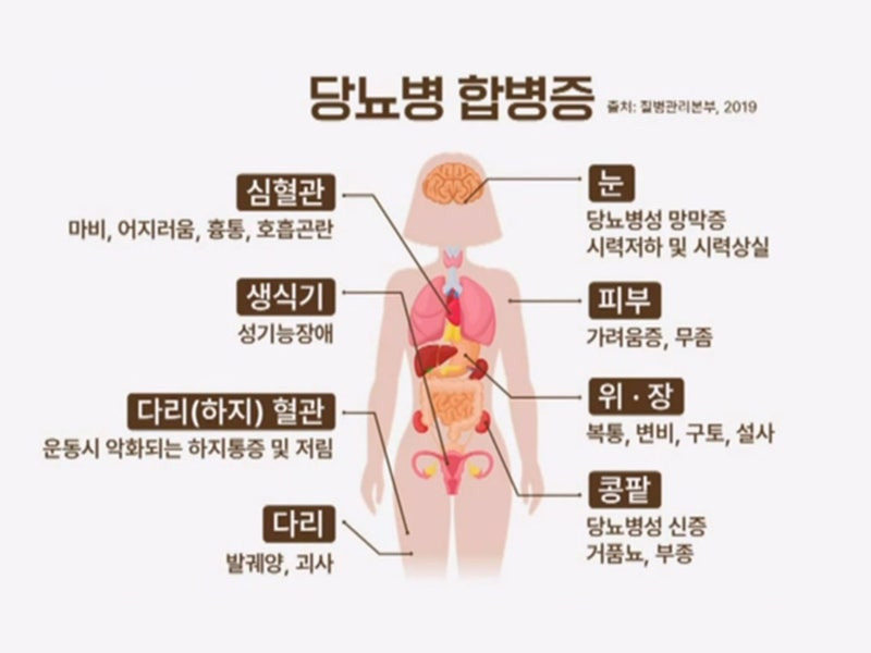 당뇨 관련 이미지