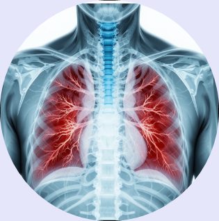 폐포자충 폐렴, Pneumocystis jirovecii 폐렴, 면역력 저하 폐질환, 노년층 호흡기질환 예방, 자연약초 폐건강, 기회감염 폐렴 고위험군, 항암 면역억제 환자 폐건강, 폐렴 증상 숨가쁨 기침, 천연항염 성분 강황 생강 폐, 고령자 건강관리 체크리스트