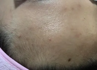 피지 얼룩 식초 분무 후 주방타월로 눌러 빼는법_17