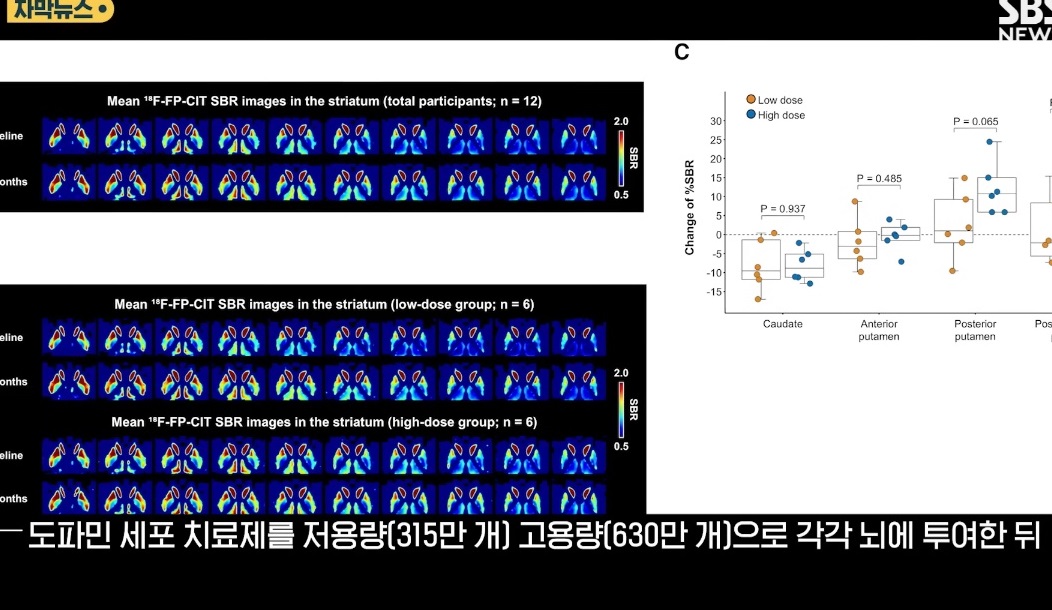 EBS-명의-파킨슨-장진우-교수