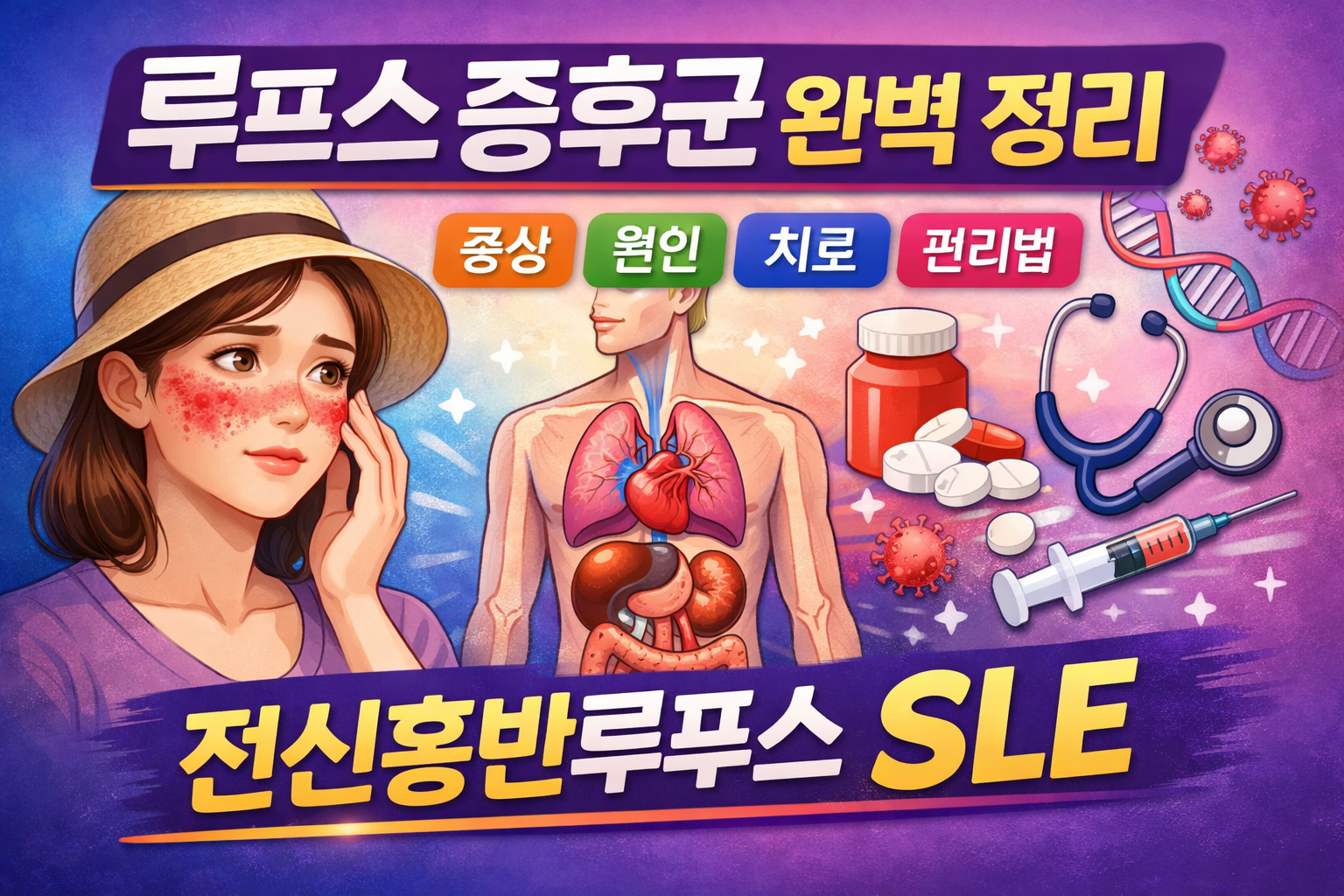 루프스 증후군