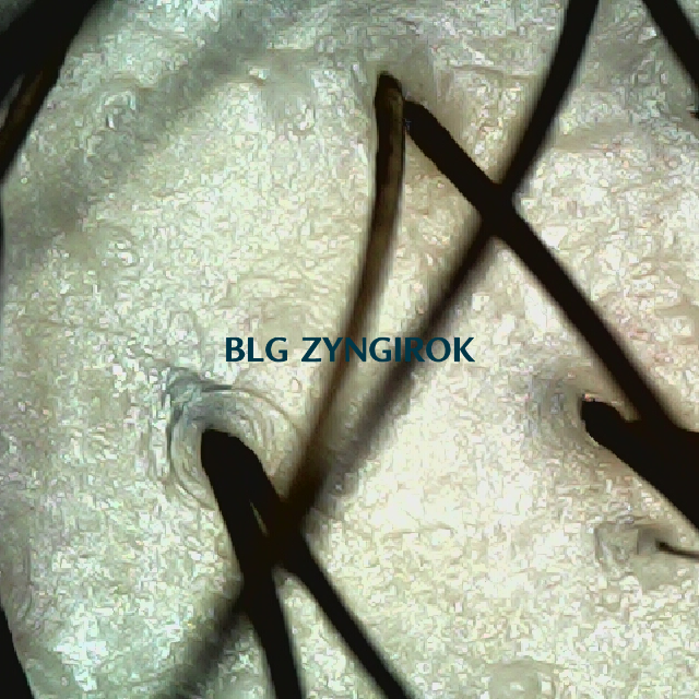 탈모 극복 프로젝트 - 정수리 두피 모습이다.