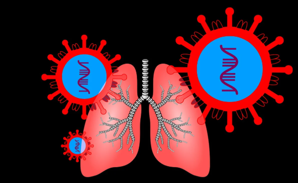 만성 폐쇄성 폐질환 관련 사진