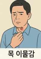 식도염 증상