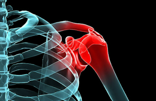 어깨 통증 원인