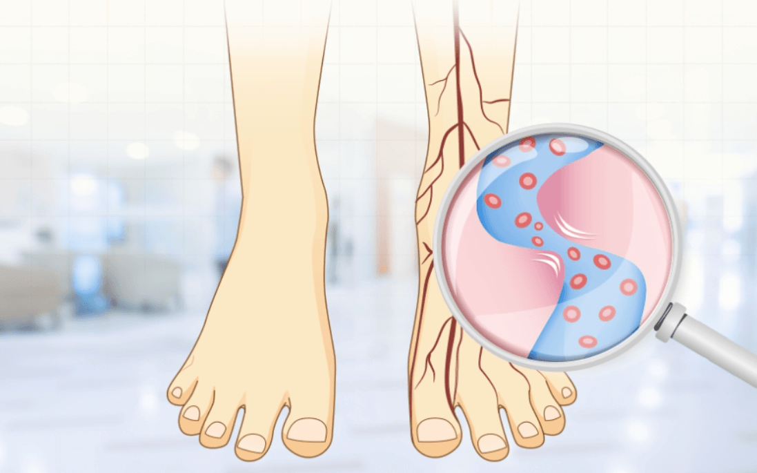 발 안 혈액 흐름의 구조