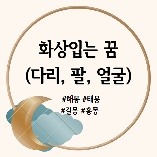 화상입는 꿈, 다리에 화상 입는 꿈, 팔에 화상 입는 꿈, 얼굴에 화상 입는 꿈 해몽