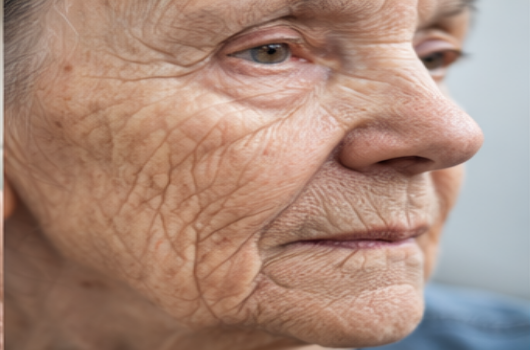 노화된 피부에 관한 사진