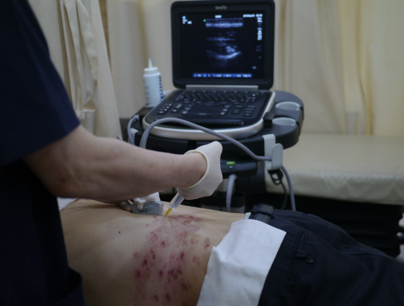 대상포진 예방접종