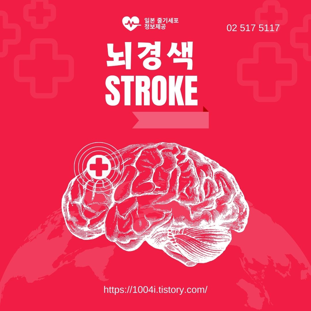 뇌경색 초기증상