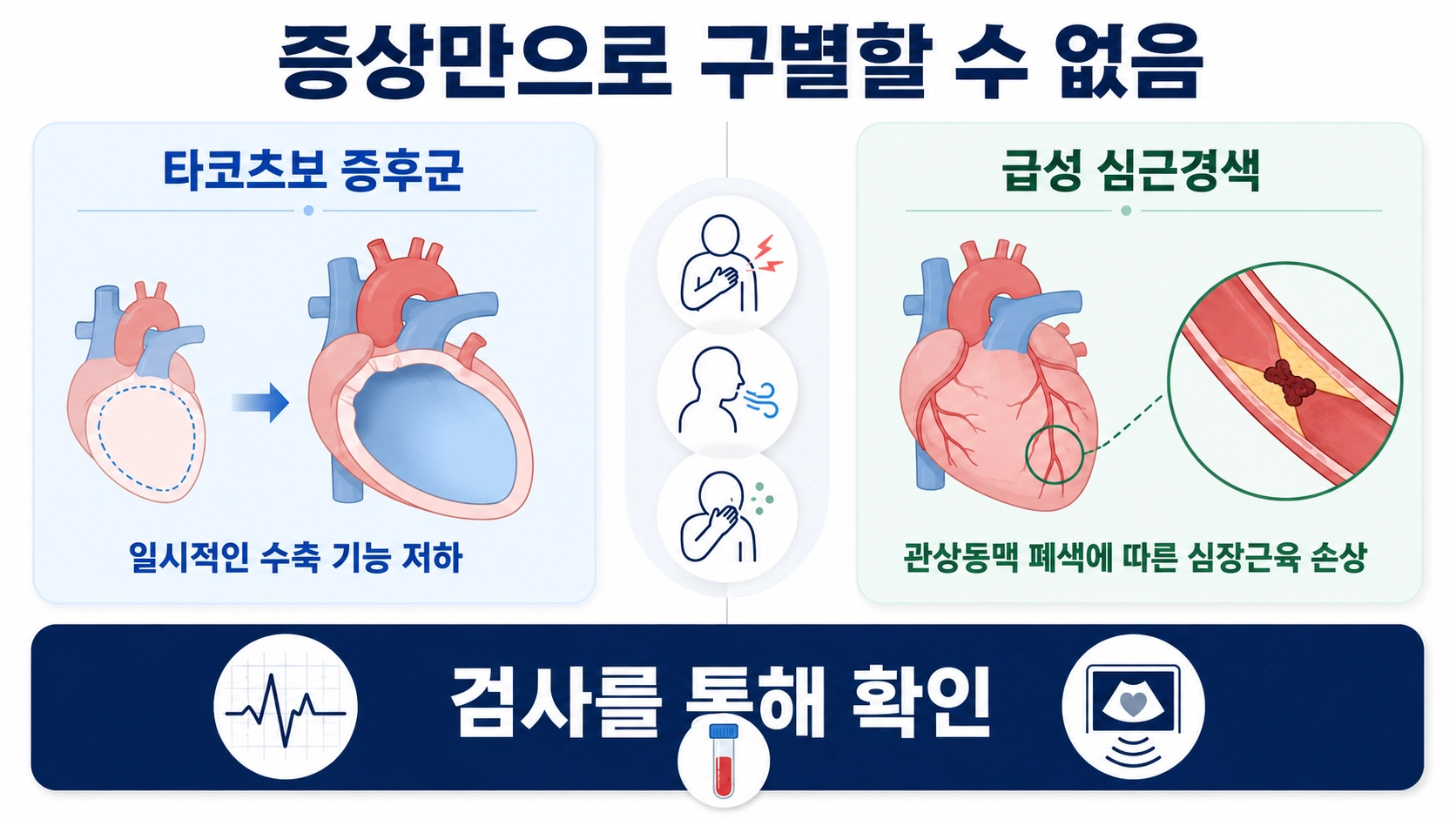 타코츠보 증후군과 급성 심근경색의 주된 변화와 증상만으로 구별할 수 없는 이유를 비교한 안내