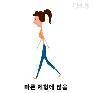 위하수증