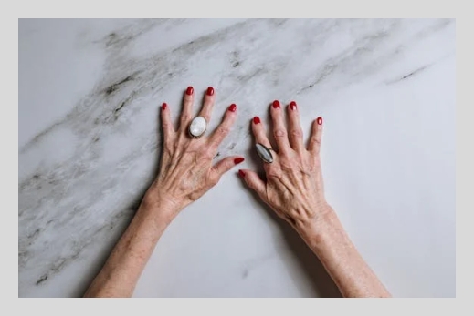 히알루론산 부작용