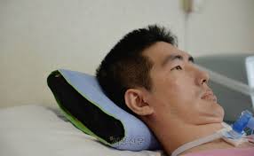 박승일 루게릭병 별세