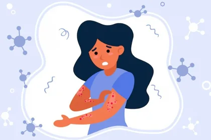 겨울철 알레르기 피부염으로 가려움과 건조함이 나타나는 피부 상태17