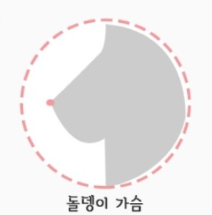 배란기 증상
